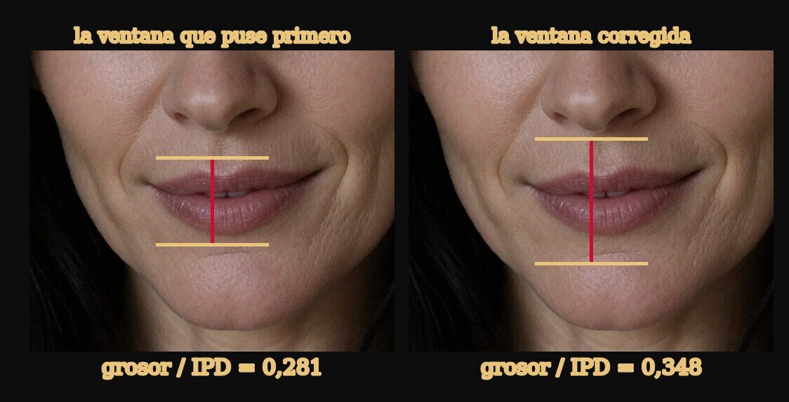 La misma boca dos veces sobre fondo negro. En cada mitad, una línea roja vertical y dos líneas amarillas horizontales que marcan los extremos de la zona medida. A la izquierda la línea amarilla de arriba cruza por encima del labio superior y el resultado es 0,281. A la derecha las dos líneas caen sobre piel limpia y el resultado es 0,348.